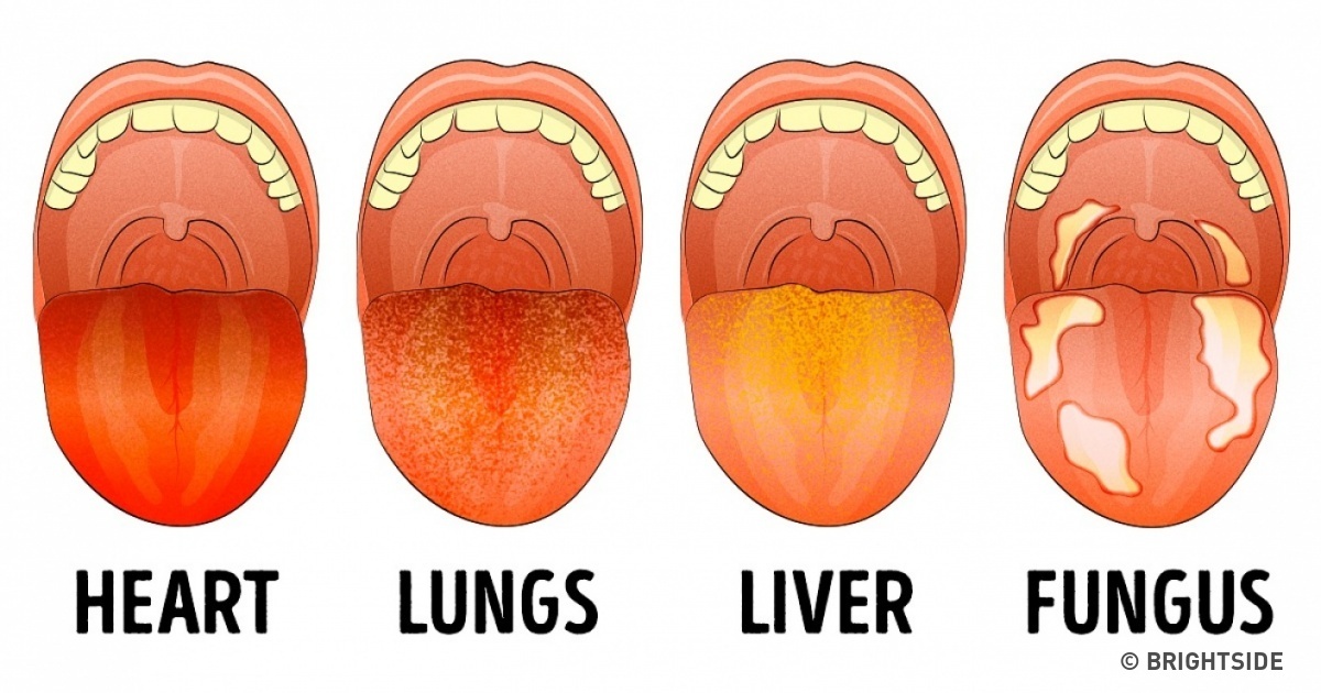 Things Your Tongue Is Trying To Tell You About Your Health Funny