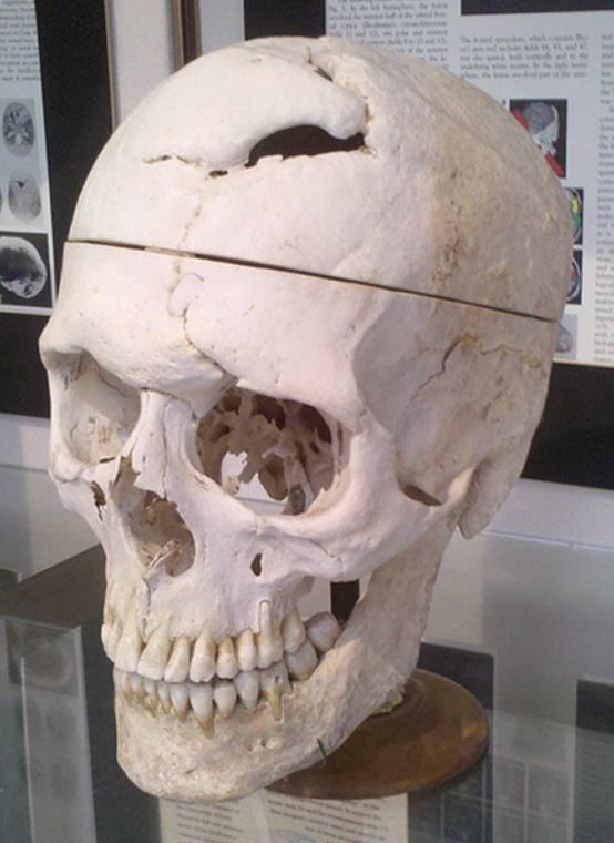 <a href="https://legacy.countway.harvard.edu/menuNavigation/chom/warren.html" target="_blank">Warren Anatomical Museum</a> in Boston, MA