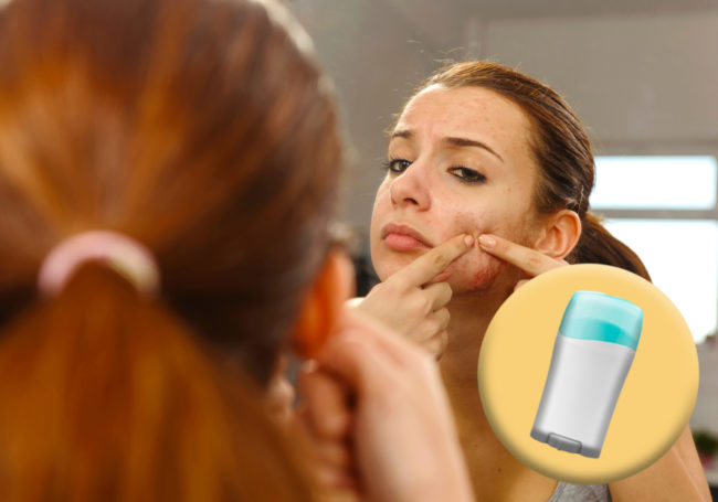 Don't pop that pimple! This isn't exactly dermatologist recommended, but if you need to zap a zit quickly, dry it out with deodorant.