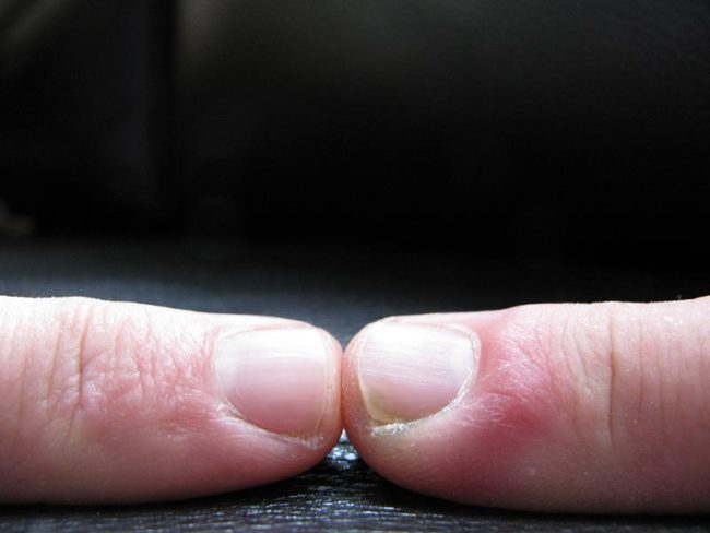 No time for a manicure? No problem. Just buff your nails with a soft brush and some toothpaste.