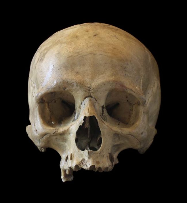 Technically, selling human skulls online is a violation of the company's terms of service. There was a loophole, however, that claimed it was okay if they were sold for medical research. That being said, there's really no way to regulate what people do with their eBay purchases.