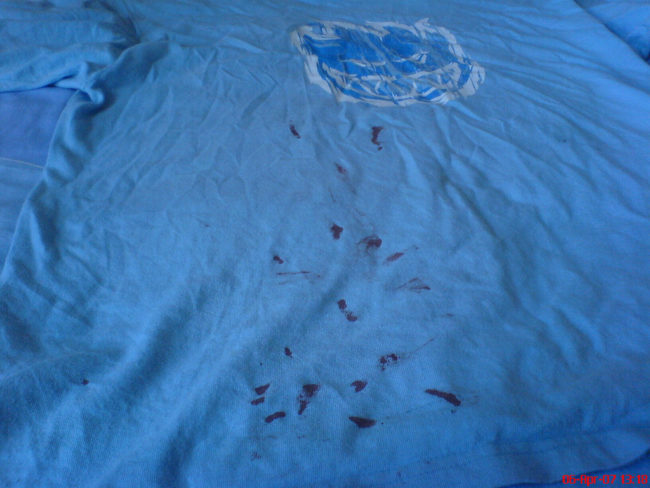 Pour some Coke on a blood-stained shirt to lift the red marks quickly.