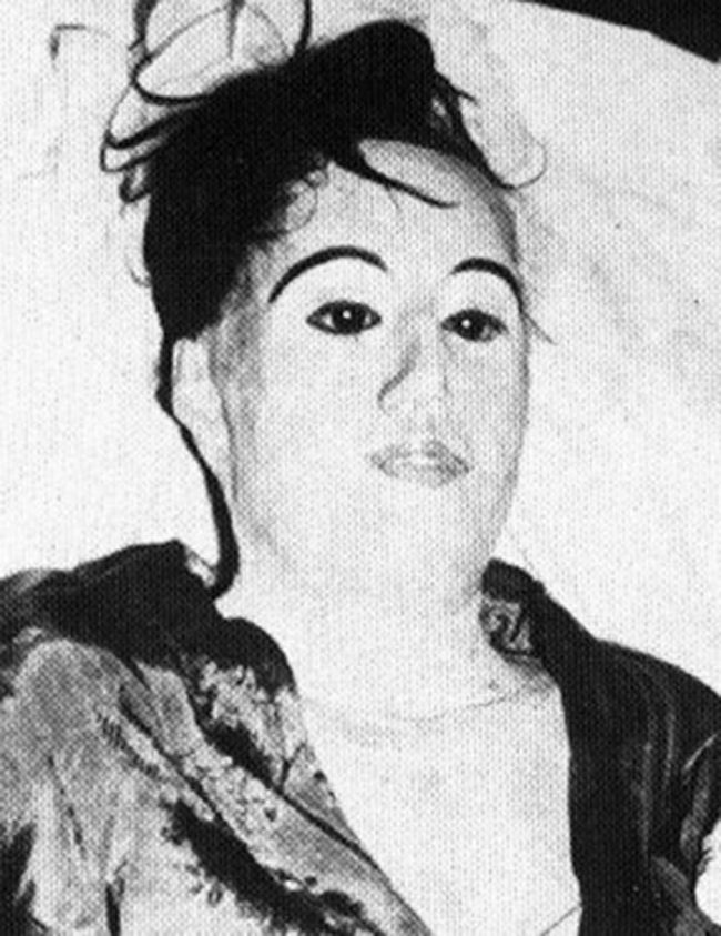 At home with the body, Tanzler attached Hoyos' bones back together using coat hangers and wires. Next, he fitted the "body" with a new set of glass eyes. As Hoyos' remains continued to decay, Tanzler replaced her skin with cloth and plaster. Eventually, he replaced her hair with a wig. He also stuffed the chest cavity with rags to help keep its original form. The body never left Tanzler's bed.