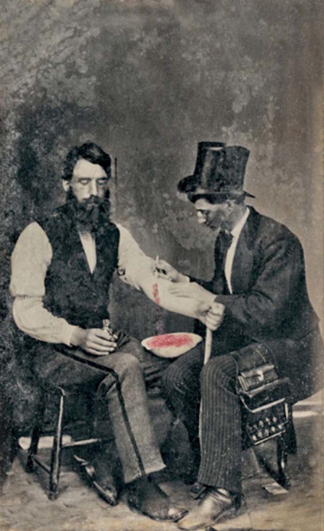 Medical advancements in the 19th century began to poke holes into theories surrounding the efficacy of bloodletting. However, despite the growing proof, the practice remained popular until the turn of the century.