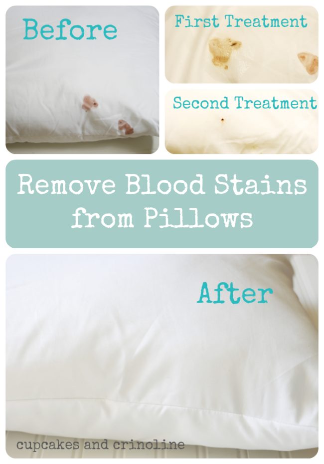 Use baking soda and hydrogen peroxide to get tough <a target="_blank" href="http://cupcakesandcrinoline.com/2014/02/26/remove-blood-stains-fabric/">blood stains</a> out of fabric.