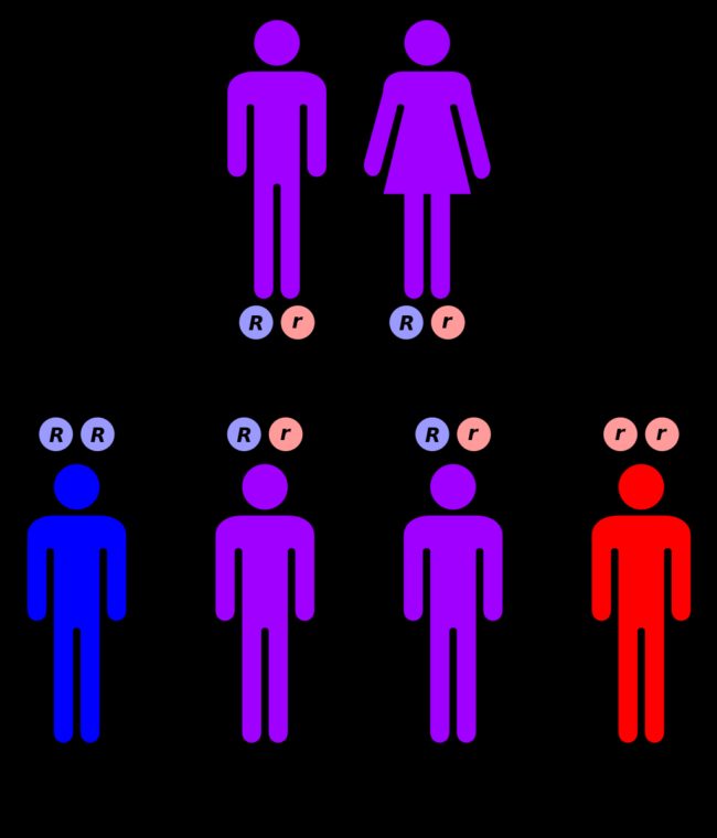 MSUD is a homozygous-recessive disorder, meaning that both parents passed on their recessive genes.