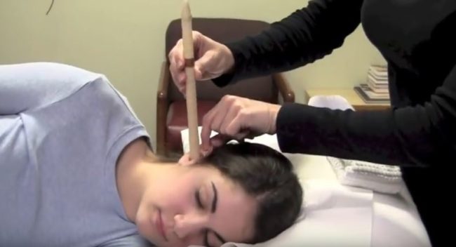 Ear candling is an alternative medical procedure that people use to remove wax buildup.  One end of a candle is placed in the ear canal, while the other is lit, supposedly creating a vacuum that draws out impurities.  The catch? This can cause injuries like burns and even perforation of the eardrum.