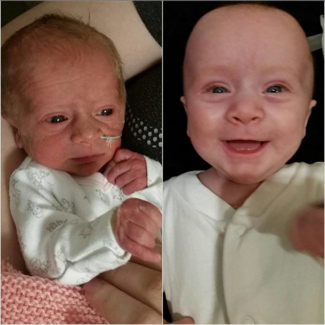 In this comparison, Natasha Bond shows the difference that time and care can make. "My little lady at two days old and three pounds, seven ounces. And now, 16 weeks old."