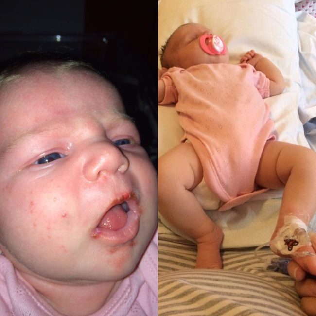  "I noticed the signs early   and got her to A&amp;E, we have now been in hospital on a drip for 3   days and have got another 2 to go. She was VERY lucky, all her tests   came back clear," she said in a <a href="https://www.facebook.com/claire.henderson.3591/posts/10207097809738910:0" target="_blank">Facebook</a> post. 