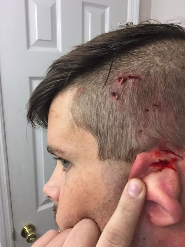 The cat's attack was so vicious that Woodard needed stitches afterward. He has a sense of humor about it all, making the photo of his injuries his Facebook profile picture.