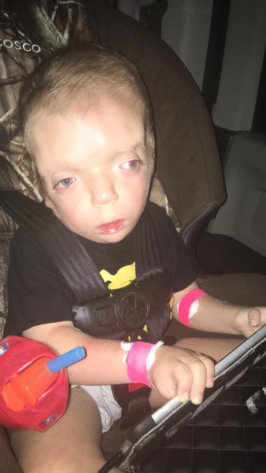 When Grayson Kole was born, doctors didn't expect him to live for more than two weeks. He had a combination of illnesses and conditions they had never seen before.