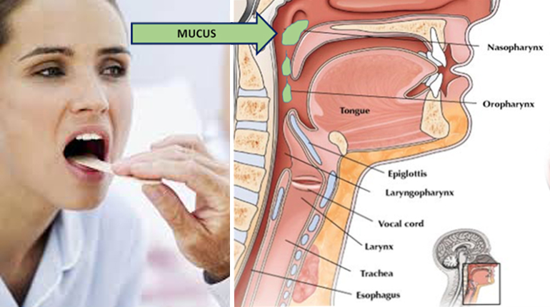 Get Rid Of Throat Mucus Faster With These Home Treatments Funny 