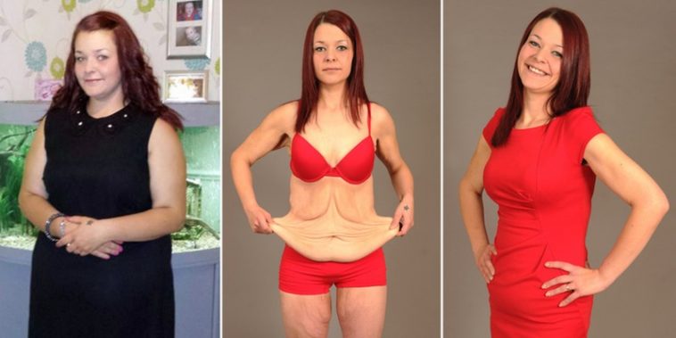 how-to-tighten-skin-after-weight-loss-effectively-funny-stories-on