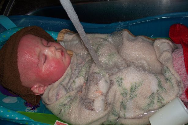 35 Doctors Couldn’t Stop Son’s “Melting” Skin… Then Mom Makes Stunning Discovery