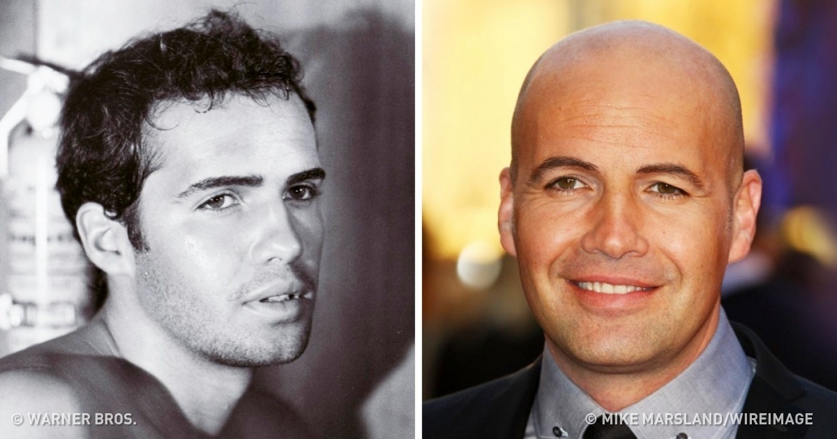 How These 12 Famous Actors Looked Before Going Bald – Funny Stories On